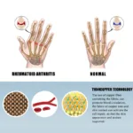 2-Pairs: Rheumatoid Arthritis Magnetic Compression Gloves - Image 5