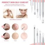 6-Pieces Set: Blackhead Remover Comedones Extractor Acne Removal Kit - Image 6