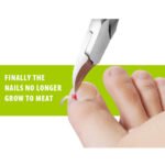 Podiatry Toe Nail Clippers for Thick/Heavy Duty Nails - Image 3
