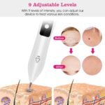 Portable Skin Tag Repair Kit with 6 Replaceable Needles - Image 8