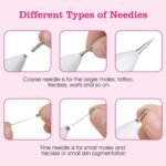 Portable Skin Tag Repair Kit with 6 Replaceable Needles - Image 10